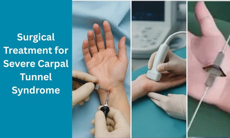 Surgical Treatment for Severe Carpal Tunnel Syndrome: Open vs. Endoscopic