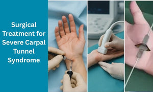 Surgical Treatment for Severe Carpal Tunnel Syndrome: Open vs. Endoscopic